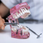 dentist implantologist showing dental bridge implant technology on human tooth jaw model.