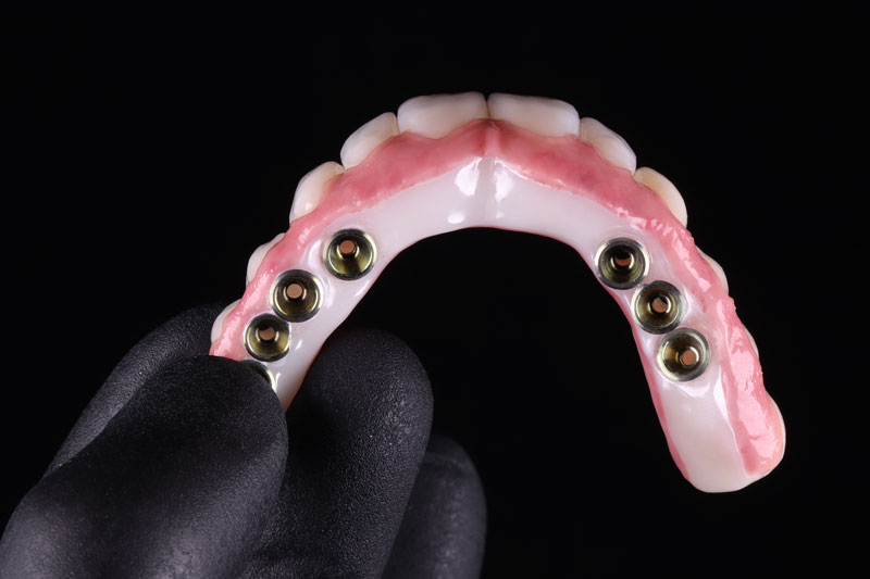 all on 6 dental implants with a full arch of teeth ready for placement onto the jaw